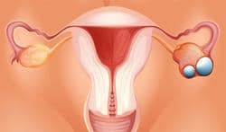 Le 8 Mai: Journée internationale du cancer de l’ ovaire